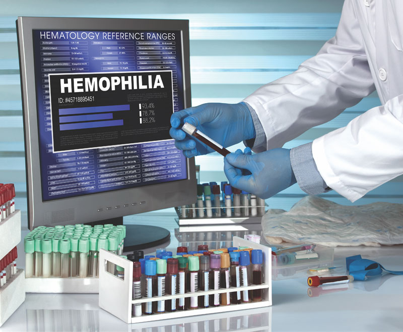 Photo of researcher handling blood vials