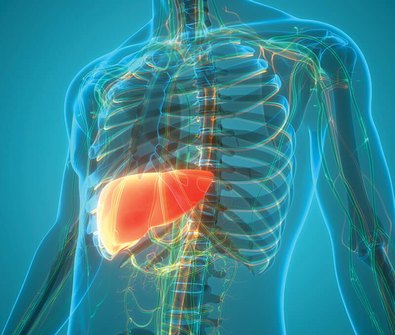 Alpha-1 Antitrypsin Deficiency