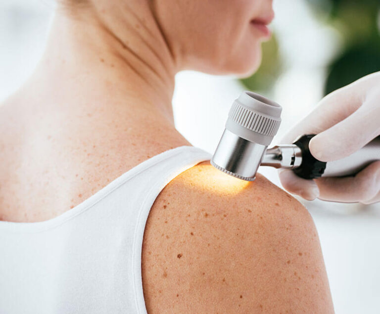 Experimental mRNA Vaccine Plus Keytruda Delays Melanoma Recurrence