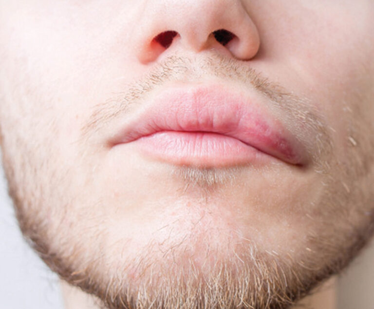 Up-close photo of a man's lower face/beard