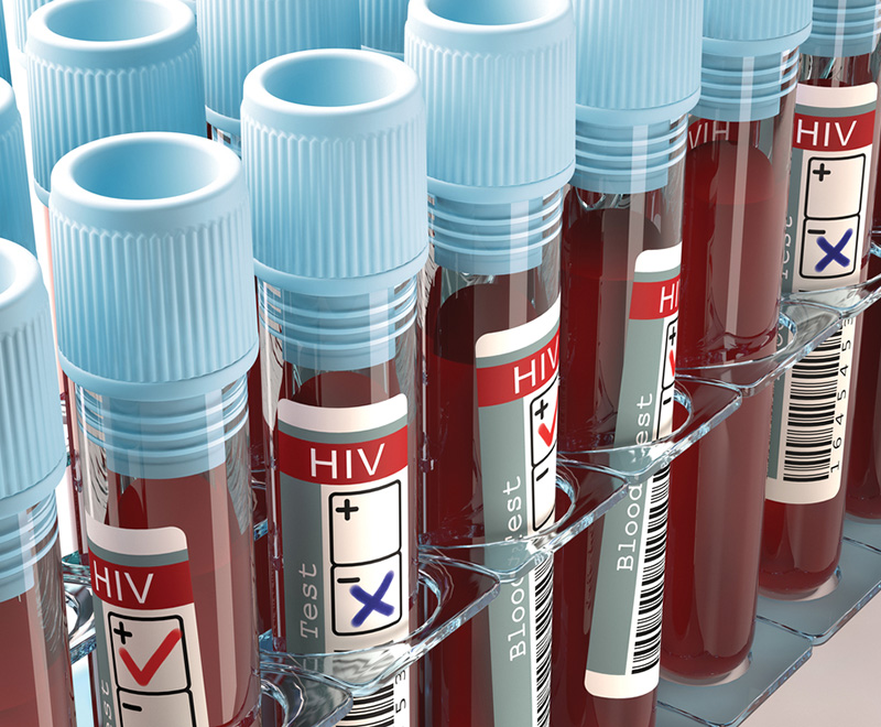 HIV blood test vials