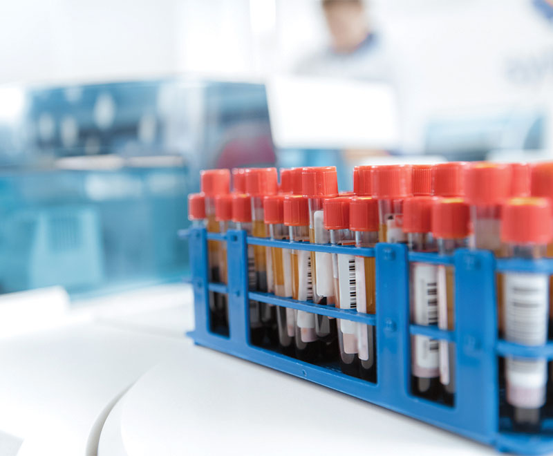 Photo of vials of blood samples in a lab.